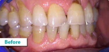 Patient Photos Depicting Before