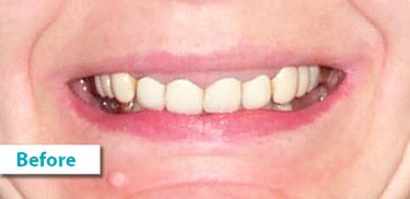 Patient Photos Depicting Before
