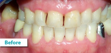Patient Photos Depicting Before