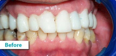 Patient Photos Depicting Before