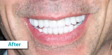 Patient Photos Depicting After