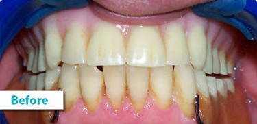 Patient Photos Depicting Before