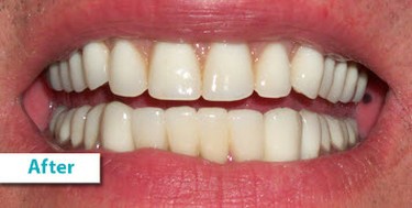 Patient Photos Depicting After