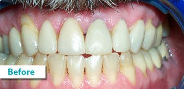 Patient Photos Depicting Before