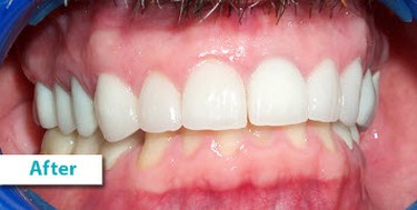 Patient Photos Depicting After