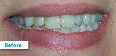 Patient Photos Depicting Before