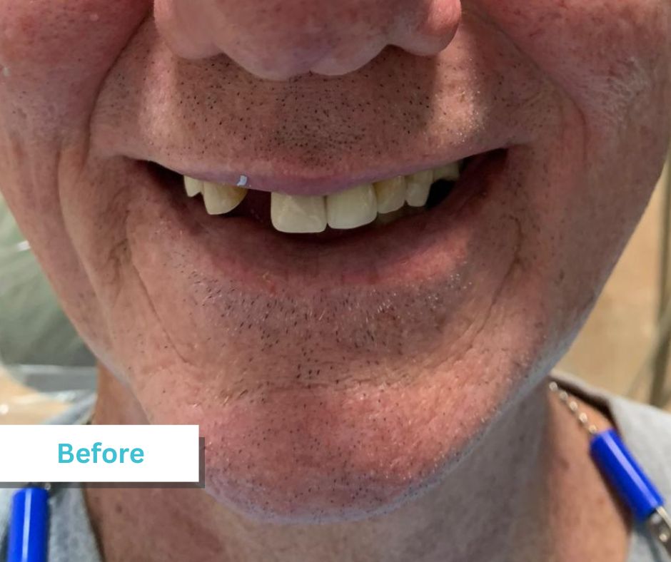 Patient Photos Depicting Before