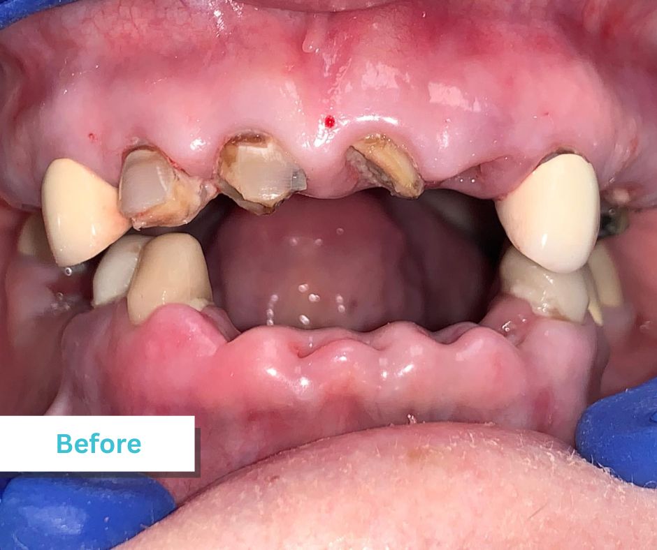 Patient Photos Depicting Before