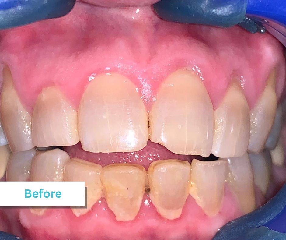 Patient Photos Depicting Before