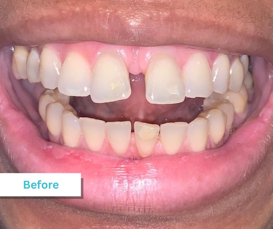Patient Photos Depicting Before
