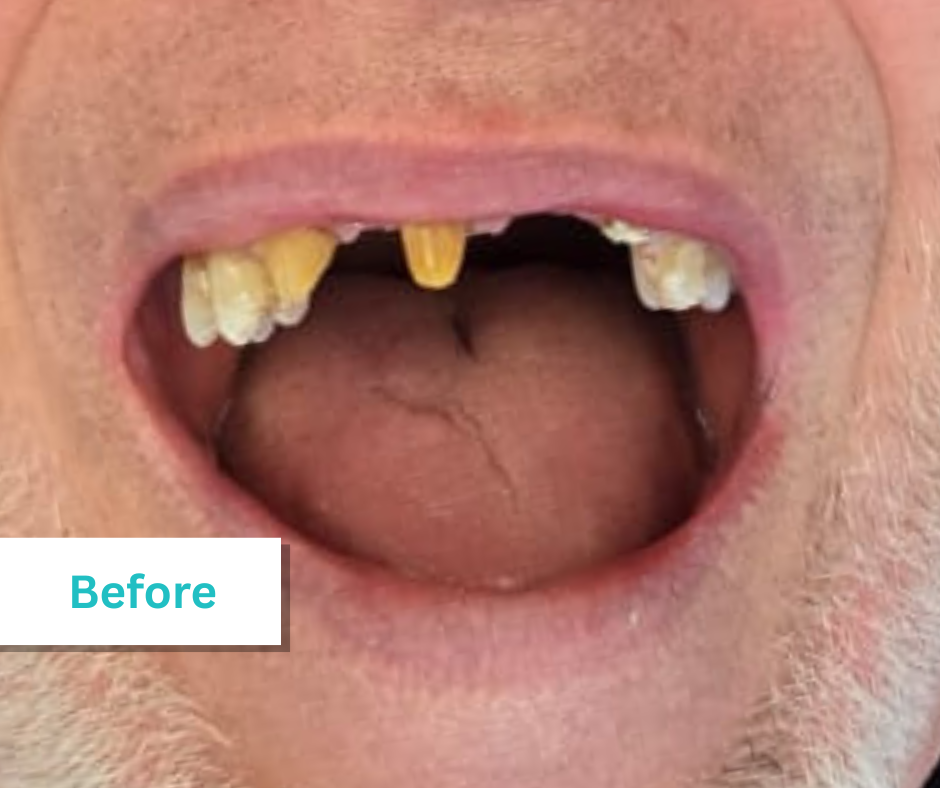 Patient Photos Depicting Before