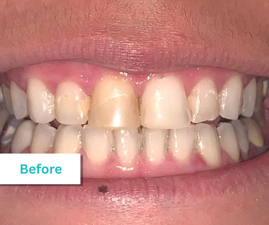 Patient Photos Depicting Before
